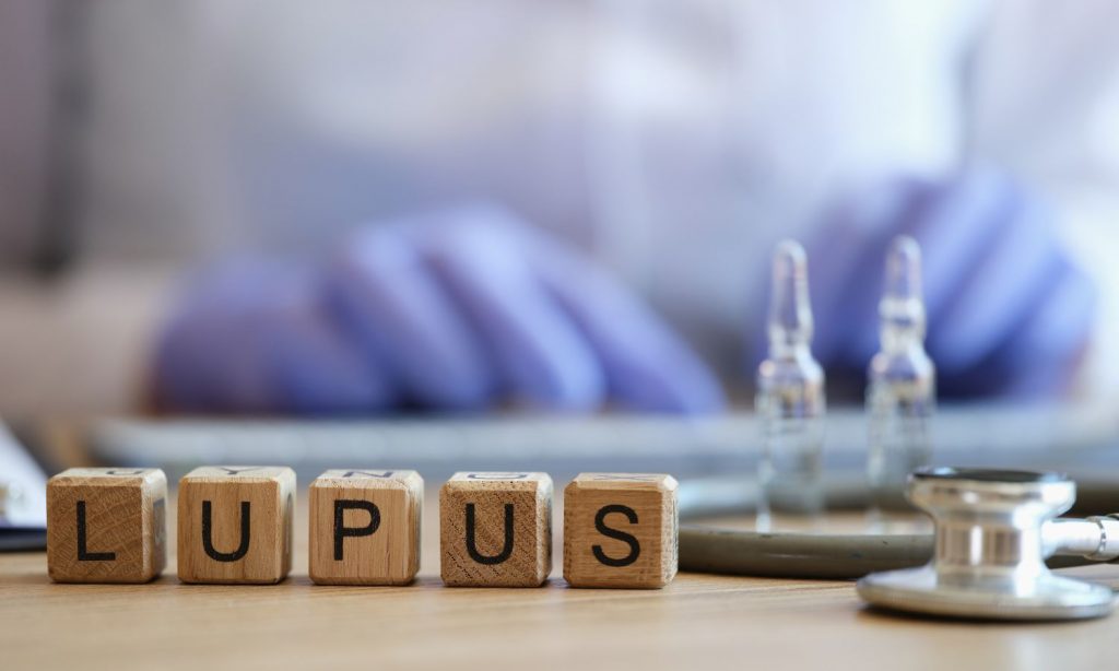Día Mundial del Lupus: Perspectivas de investigación en la USS